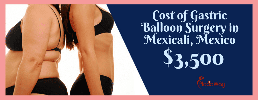 Cost of Gastric Balloon in Mexico